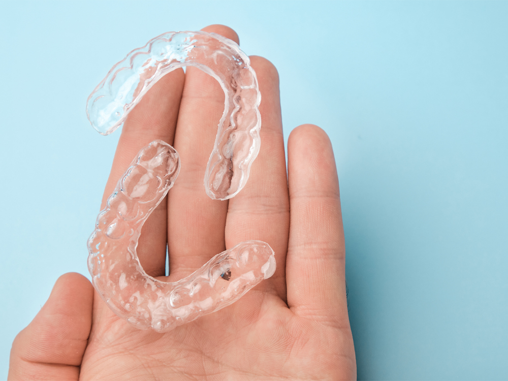a set of clear aligners being held on the fingers of a patient