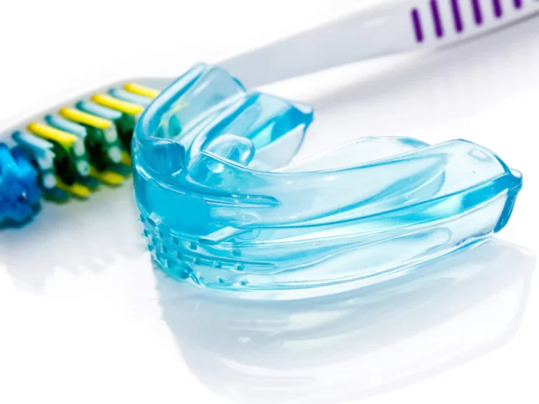 Dental mouthguards and dental nightguards available at Habersham Dental in Savannah, GA